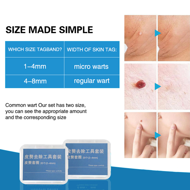 20pcs/Box Flesh Nevus Removal  - Men Accessories Combo review and price